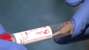 Covid-19 hospital patient numbers continue to rise 