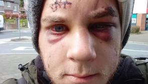 Fundraiser launched for Croatian man left with brain bleed after friend killed in Dublin assault
