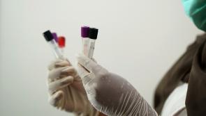 Doctor expresses concern over lack of HPV screening after man with 'genital warts' dies