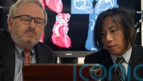 New approach to diagnosing heart disease hailed as potential ‘game changer’