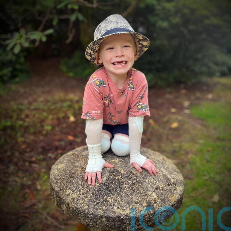 Book about &lsquo;warrior&rsquo; four-year-old helps classmates understand skin condition