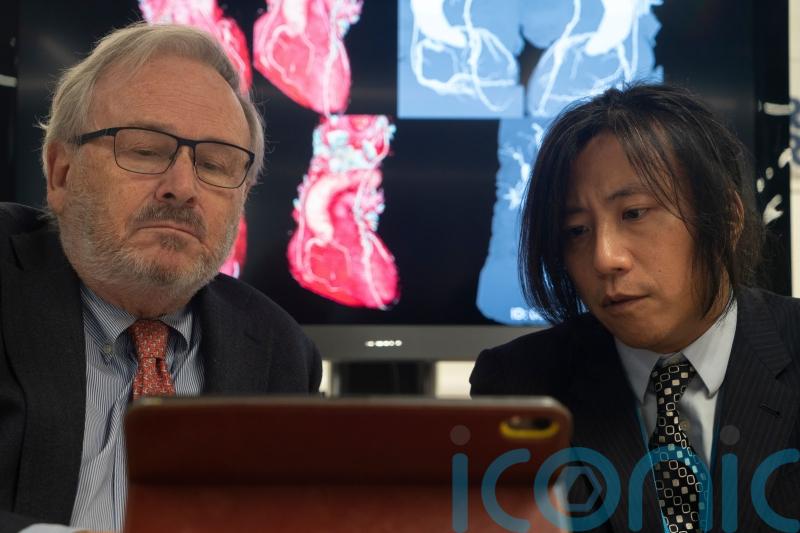 New approach to diagnosing heart disease hailed as potential ‘game changer’